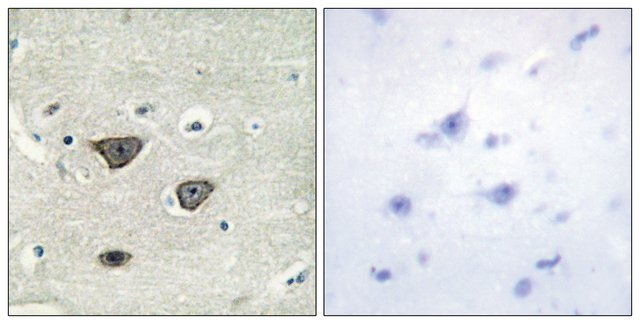 AntiCDH8 antibody produced in rabbit