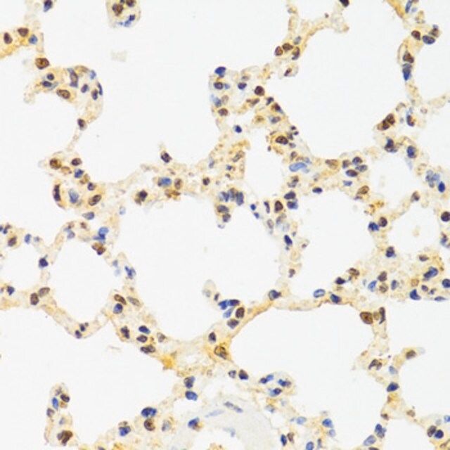 AntiSUZ12 antibody produced in rabbit