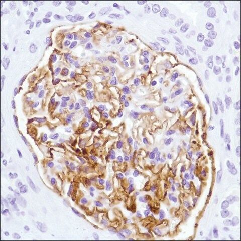 CD35 (U4) Rabbit mAb