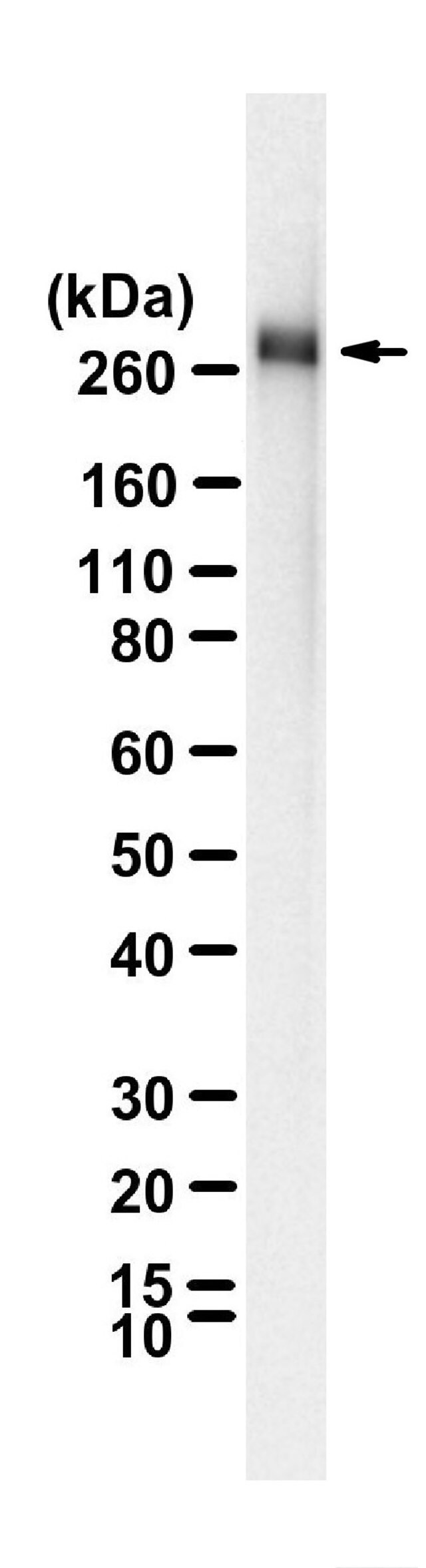 anti-myosin-heavy-chain-7-antibody-clone-1b19-zoomab-rabbit-monoclonal