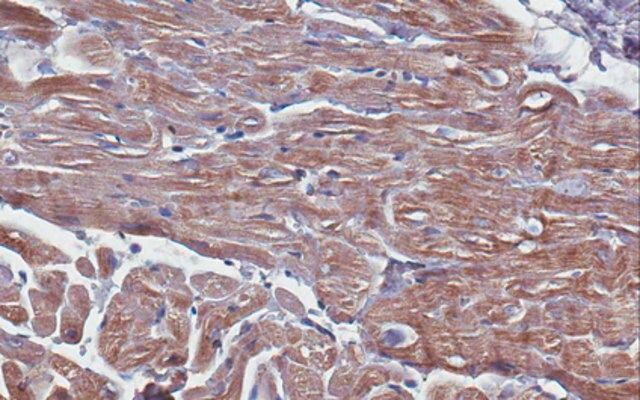 Anti Troponin T Cardiac Muscle Antibody Clone 9C2 1 anti-troponin-t-cardiac-muscle-antibody-clone-9c2-1