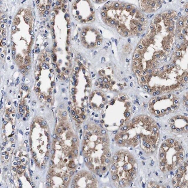 PDCD6/ALG-2 (L3) Rabbit mAb