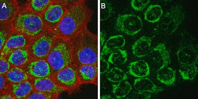 GSDMD (E6) Rabbit mAb