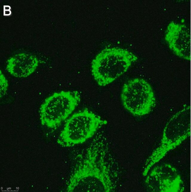 GSDMD (E6) Rabbit mAb main image 0