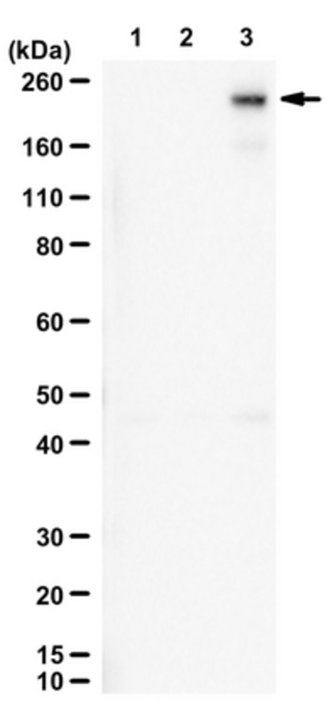 Anti phospho LRP 6 Thr1479 anti-phospho-lrp-6-thr1479