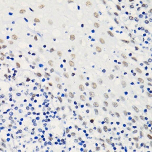Anti acetyl histone h4 k5 antibody produced in rabbit