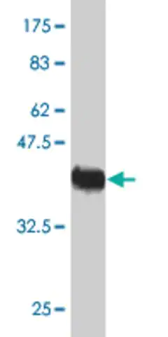 Monoclonal AntiUBE2C antibody produced in mouse