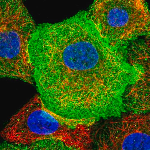 CD38 (F9) Rabbit mAb main image 0
