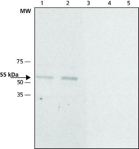 Calsequestrin 2 (O2) Rabbit mAb main image 0
