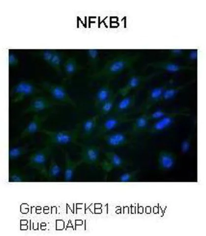 AntiNFKB1 antibody produced in rabbit