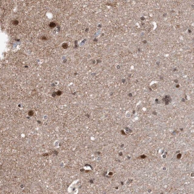 AntiDUSP22 antibody produced in rabbit