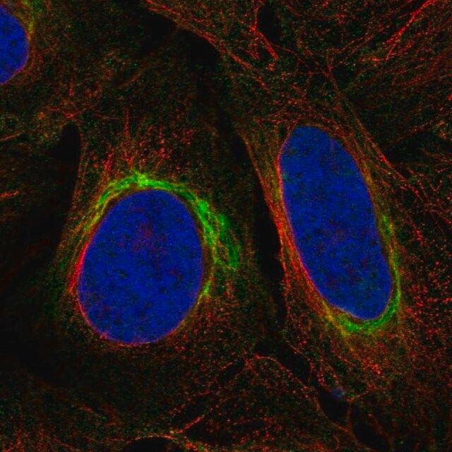 DISC1 (B9) Rabbit mAb main image 1