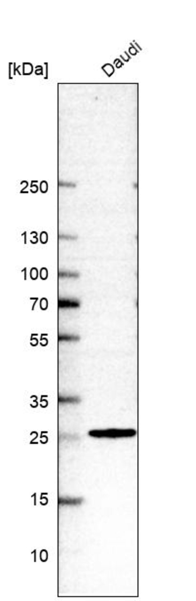 AntiRPL10A antibody produced in rabbit