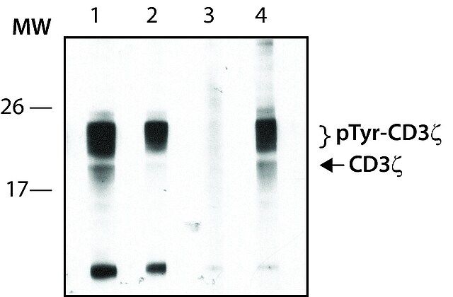Phospho-CD3 zeta (Tyr83) (W3) Rabbit mAb main image 0