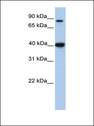 ACAT1 (N8) Rabbit mAb