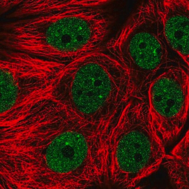Anti-ENOPH1 antibody produced in rabbit