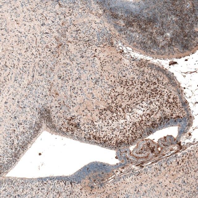 Monoclonal Anti-AUTS2 antibody produced in mouse