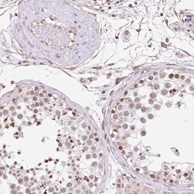 Anti orc3 antibody produced in rabbit