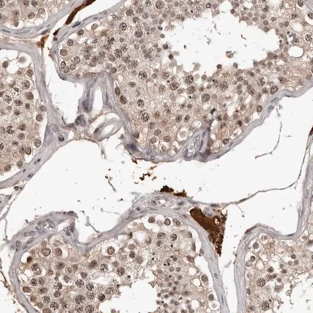 Anti orc1 antibody produced in rabbit