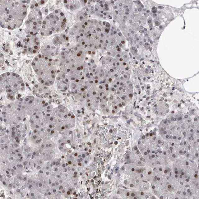 Anti orc1 antibody produced in rabbit