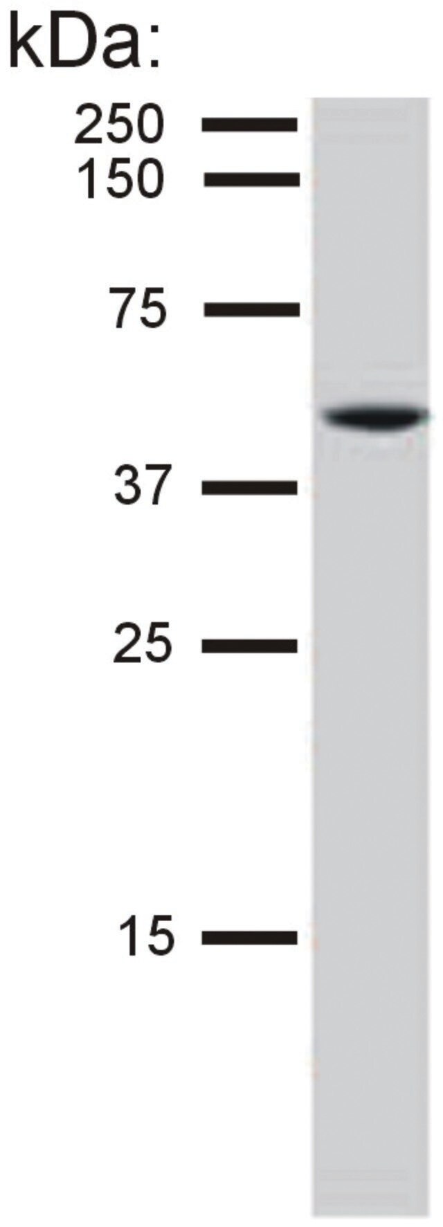 Monoclonal Anti-Cytokeratin 8 antibody produced in mouse